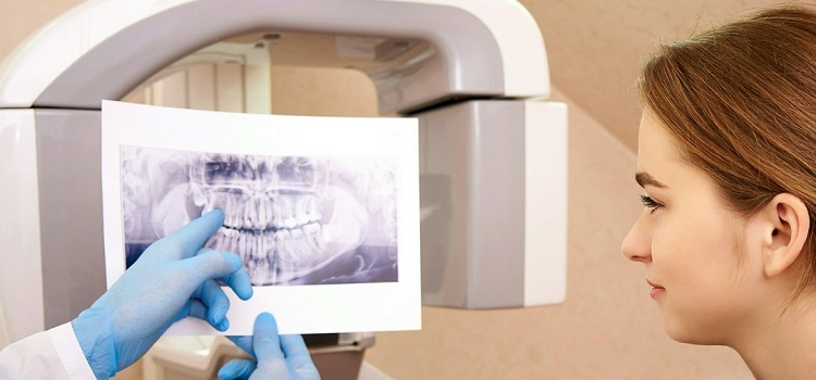 tomografia komputerowa zębów